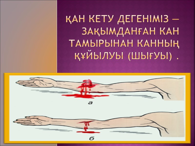 Қан кету дегеніміз — зақымданған кан тамырынан канның құйылуы (шығуы) .